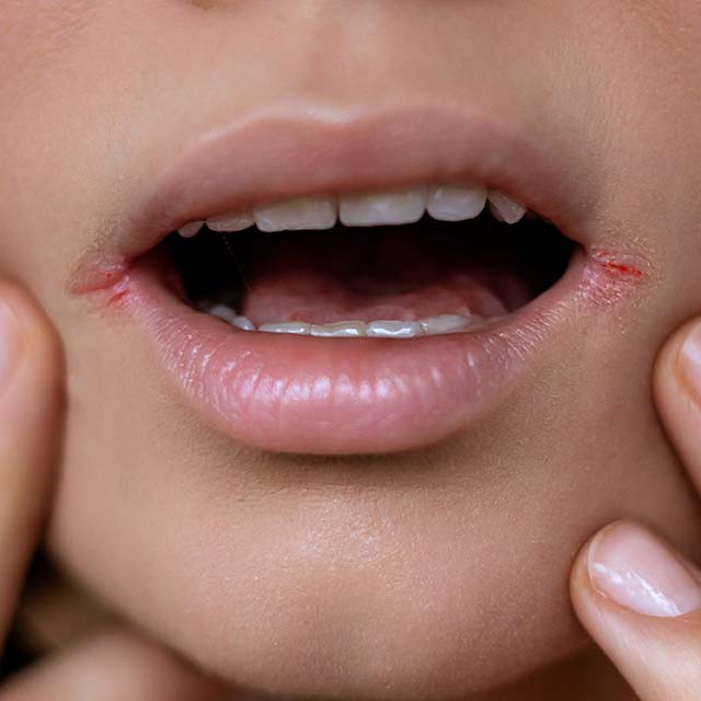 Dental Cleanings in Lodi, CA