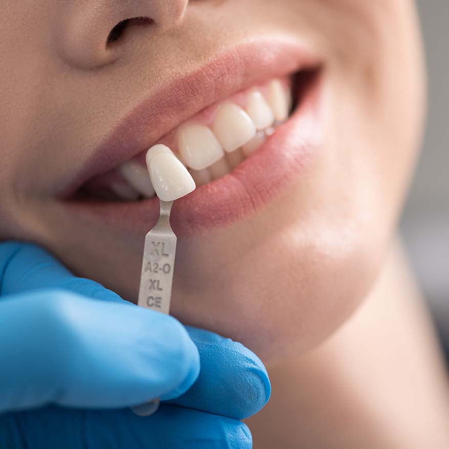 Dental Implants in Lodi, CA